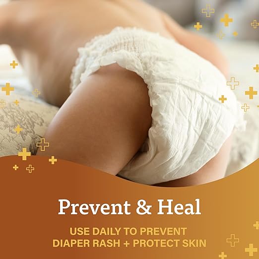 A+D Original Diaper Rash Ointment, Skin Protectant With Lanolin and Petrolatum, (Packaging May Vary) Cream 16 Ounce (Pack of 1)